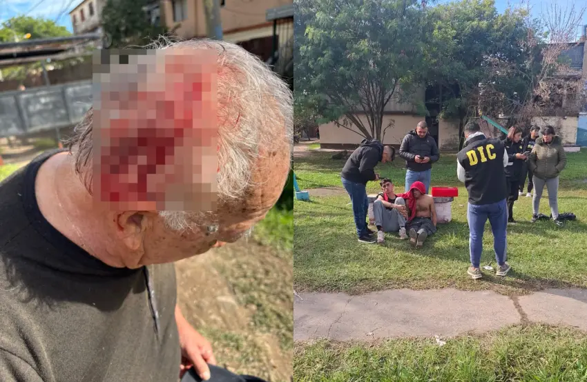 Violento asalto a un jubilado en Resistencia: detuvieron a dos sospechosos tras una feroz agresión por un celular